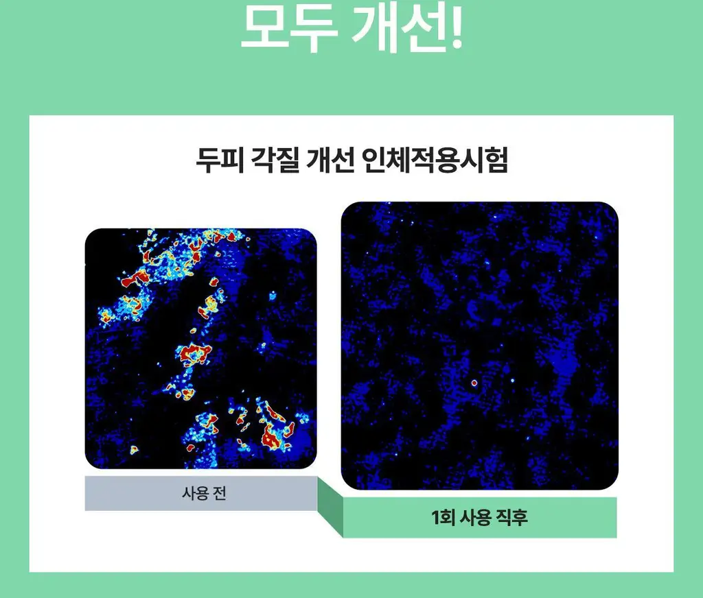 [허경환 PICK/현대약품특허]마이녹셀 포어클렌징 스칼프 샴푸 480ml 상세페이지 15